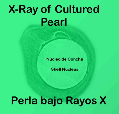 X-Ray of cultured pearl