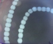 Naturalstand X Ray.JPG