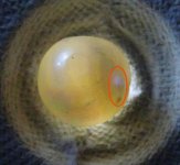 bead graft1.jpg