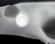 X-Ray1-Sngle-1.jpg