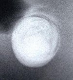 X-Ray1-SngleBlwUp-2.jpg